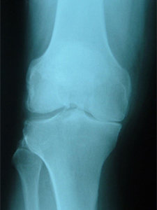 Good to the bone